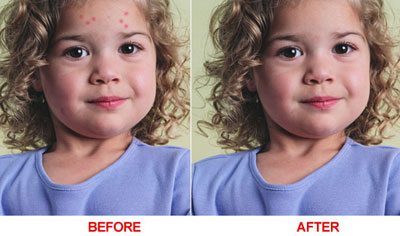 Removing Wrinkles