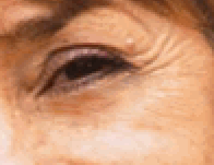 Removing Wrinkles in Photohop  image 4