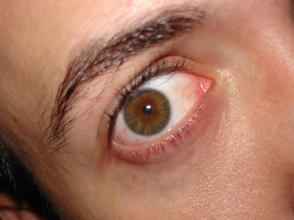 Hulk Eyes Effect image 1