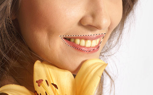 Create Hollywood Smile image 1