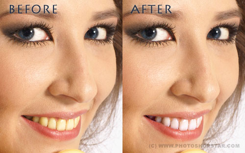 Create Hollywood Smile Tutorial: Final Result