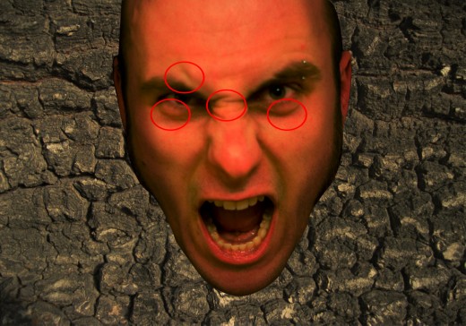 Img