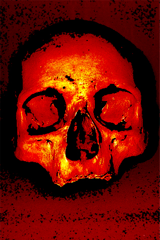 Img