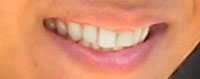 Whitening Teeth Tutorial: Final Result