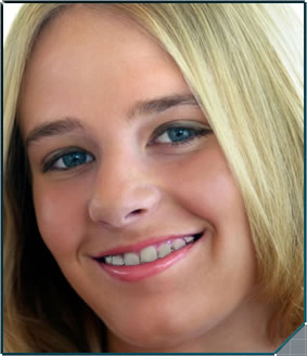 Removing Braces Tutorial: Final Result