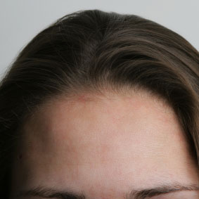 How to fix blemishes in photos