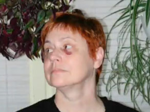 The Patch Tool (Video Tuturial)