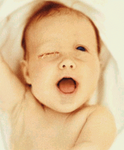 Photomanipulation - Disfigure and Distortion in Adobe Photoshop