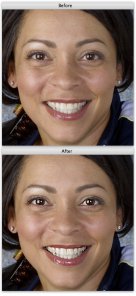 Lasso Up Eyes That Sparkle